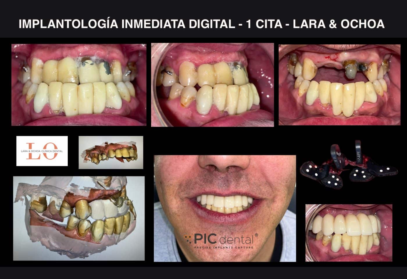 Lara & Ochoa incorpora la última tecnología para ofrecer tratamientos dentales innovadores, precisos y de excelente calidad 2