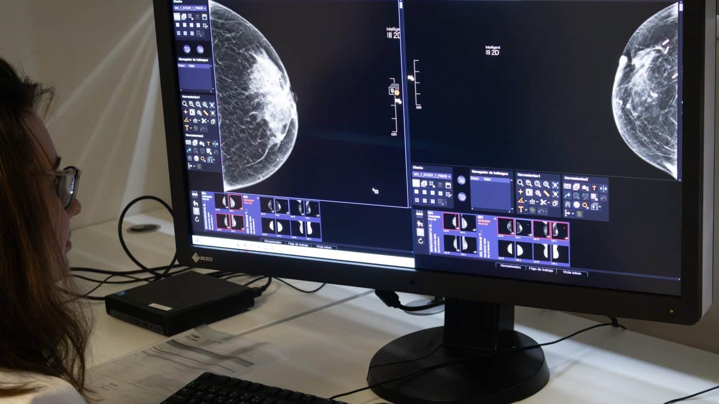 Rioja Salud adquiere un nuevo mamógrafo digital para la Unidad de Mama del San Pedro 1